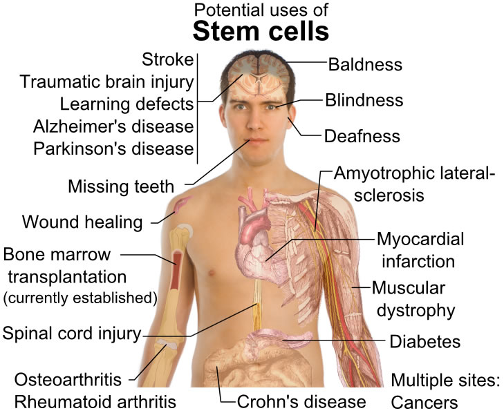 stemcelltreatment